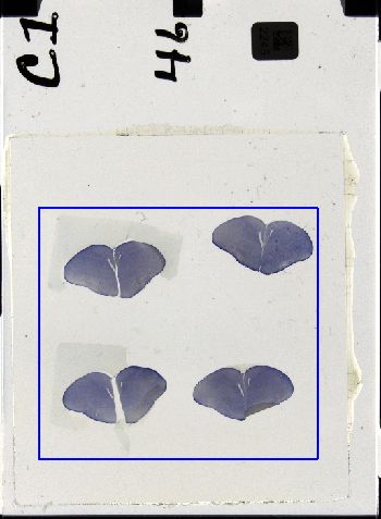 Media type: image; Special Collections 3298   shows specimen_part histological serial section;